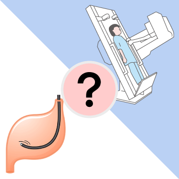 胃カメラと胃透視検査（バリウムの検査）